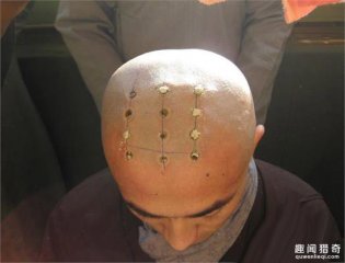 和尚头上为什么有点？一般都是几个？