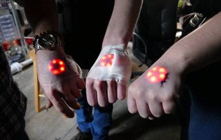 你敢吗? 科幻变现实  皮下植入LED灯成流行